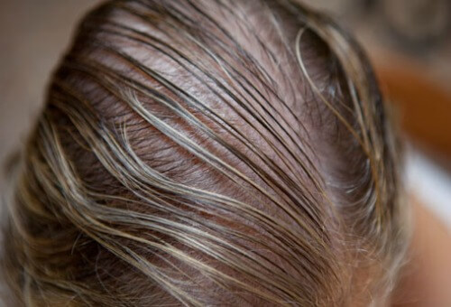 Java Talk: Are You Suffering From Hair Loss?