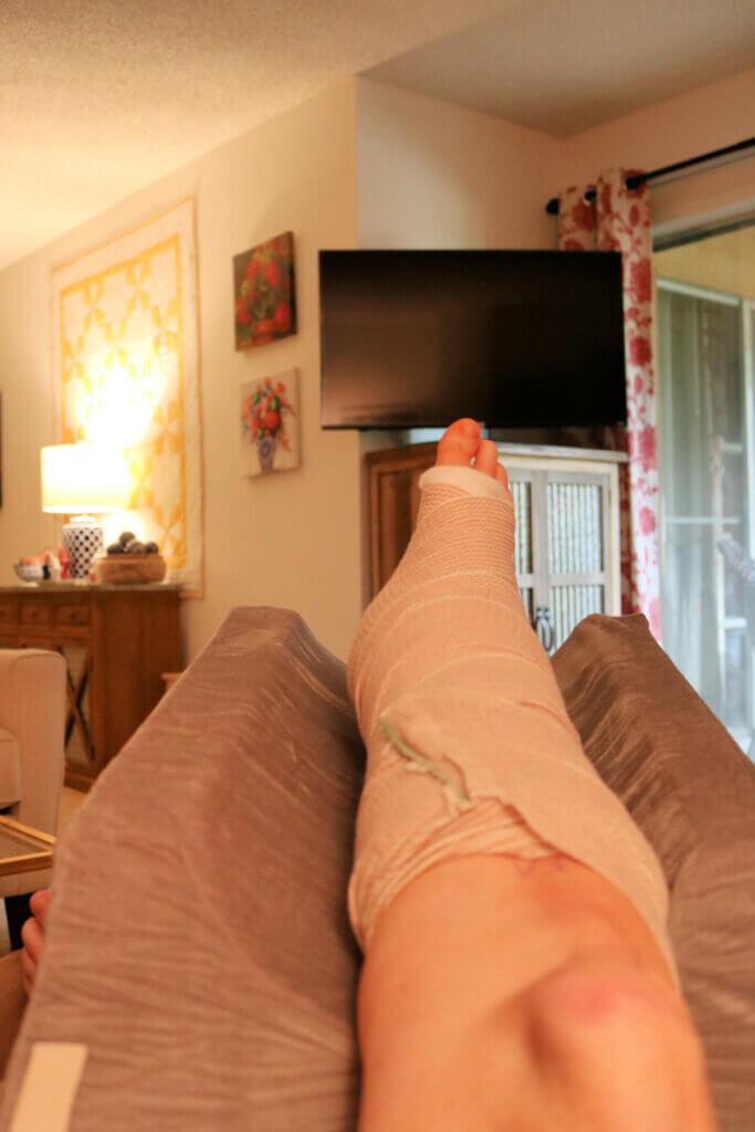 In Day 1 After Ankle Surgery, this is me in my recliner. I have my cast elevated to  help with pain.